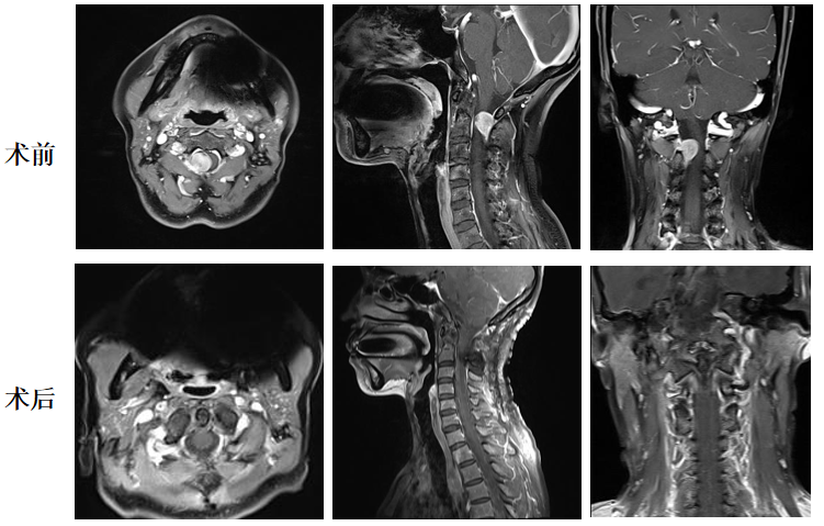 术前术后.png